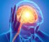 Mental Health